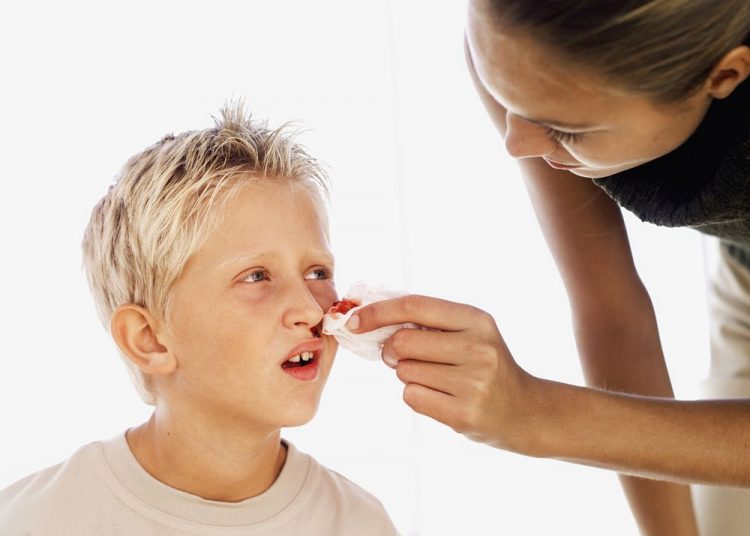 Šta uraditi kada dete krvari iz nosa?