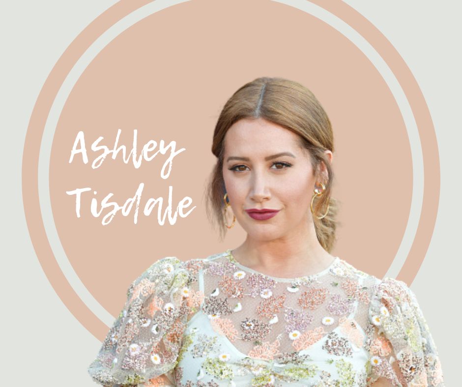 Ashley Tisdale, alopecija