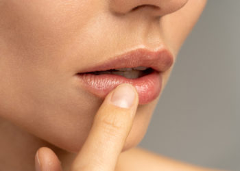 Suve i ispucale usne zimi: 6 razloga zašto se suše i pucaju usne; žena dodruje svoje usne