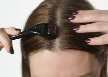 Gubitak kose: Može li mikronidling da spreči opadanje kose; devojka tretira kožu glave mikroiglicama