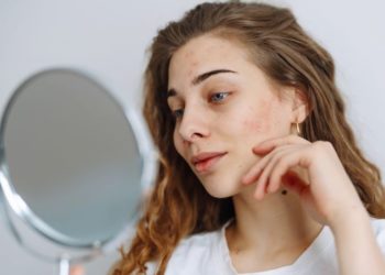 Kako šećer utiče na kožu i kakve tragove ostavlja na licu; dugokosa devojka posmatra svoje lice u ogledalu