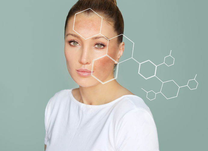 traneksaminska kiselina protiv fleka na licu