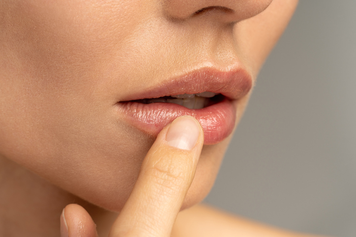 promene na usnama, šta usne govore o zdravlju